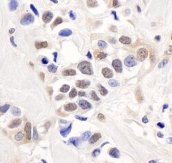 PALB2 Antibody, Novus Biologicals 100 &mu;L | Buy Online | Novus Biologicals | Fisher Scientific